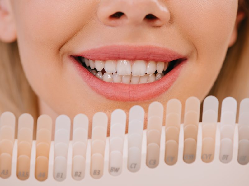 cropped view of smiling woman holding teeth color palette, teeth whitening concept